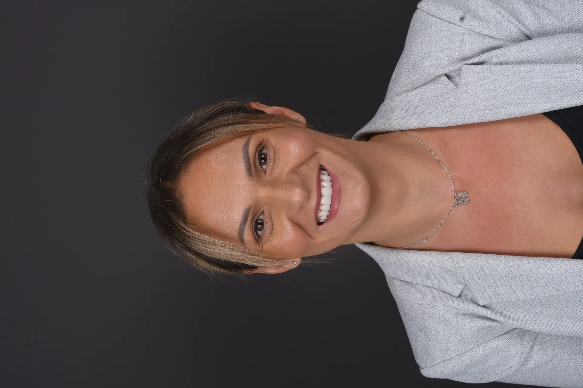 Caz Adelina: estetică dentară premium
