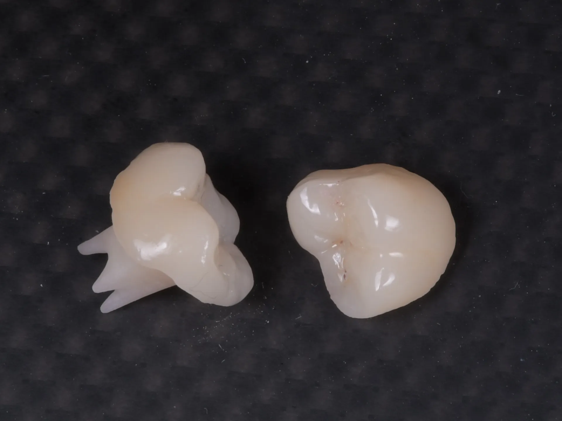 După endodonție — protecție protetică recomandată