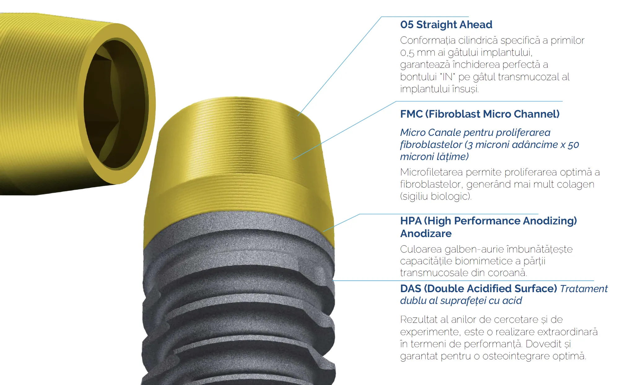 Implant dentar — echipament digital de chirurgie ghidată