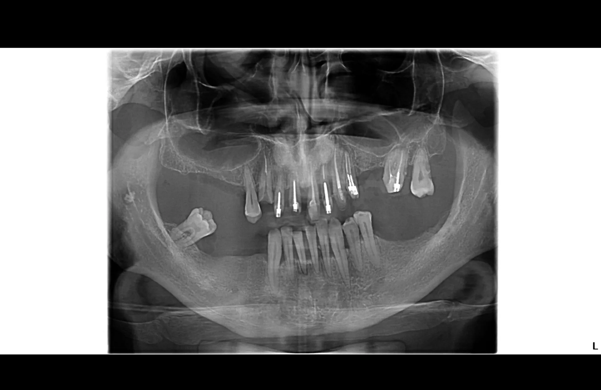 Parodontologie — sănătatea gingiilor și a țesuturilor de suport
