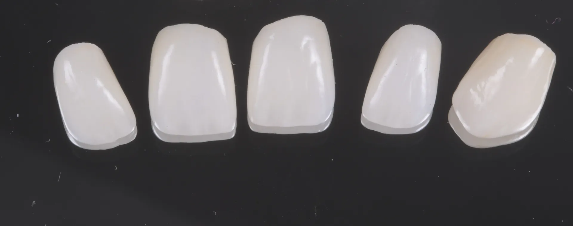 Fațete dentare ceramice - rezultat final
